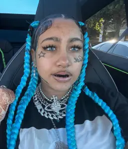 Dentists warn kids against viral TikTok trend resulting in ‘damage they’ll carry for decades’