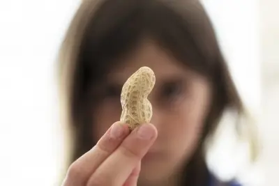 This parenting hack has prevented 60,000 kids from developing peanut allergies in the last decade